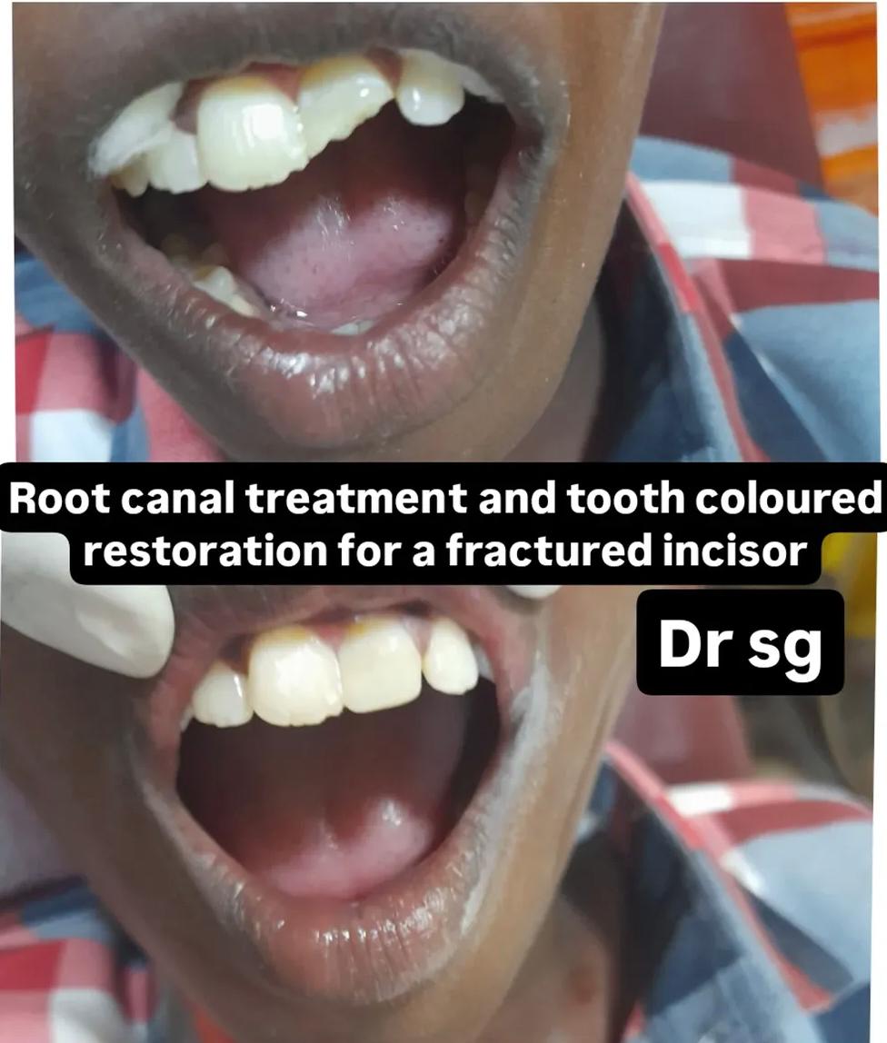 Before and after dental transformation