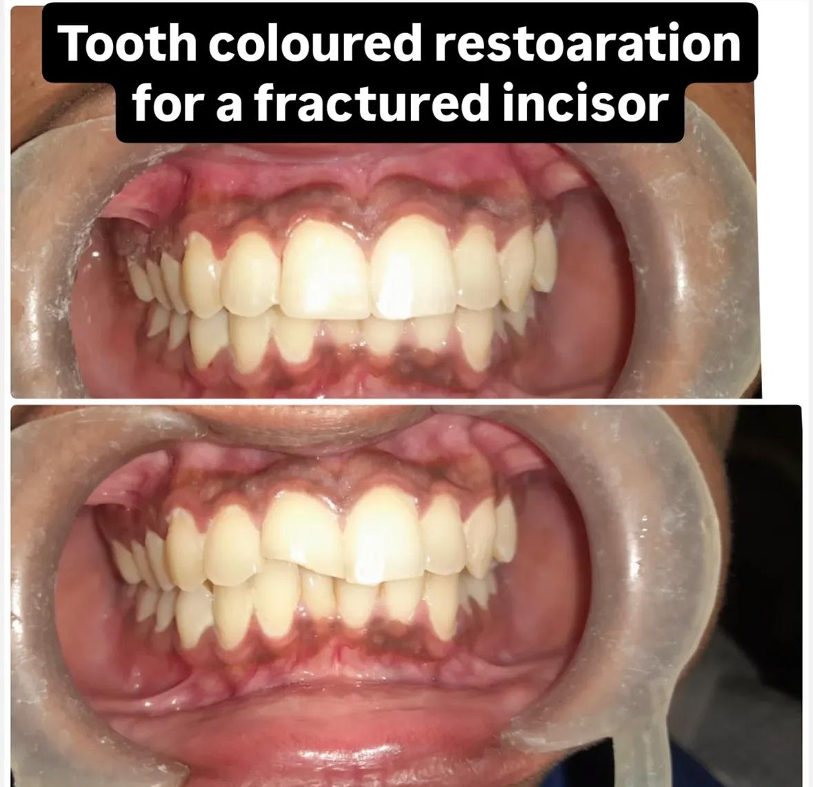 Before and after dental transformation